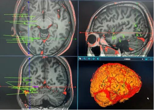 640 (7)_副本 640 (7)_副本