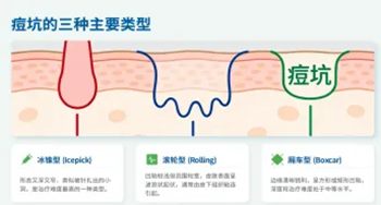 640_副本 640_副本