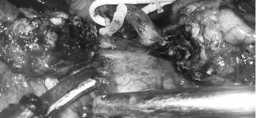 640 (1)_副本 640 (1)_副本