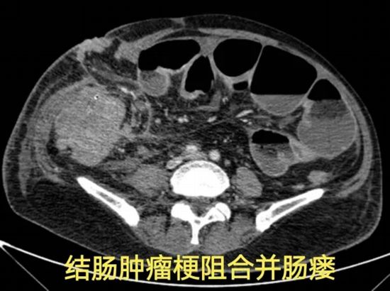 640_副本 640_副本