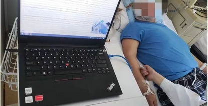 没有抽搐也能称为癫痫发作？